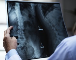 radiology technician reviewing x ray